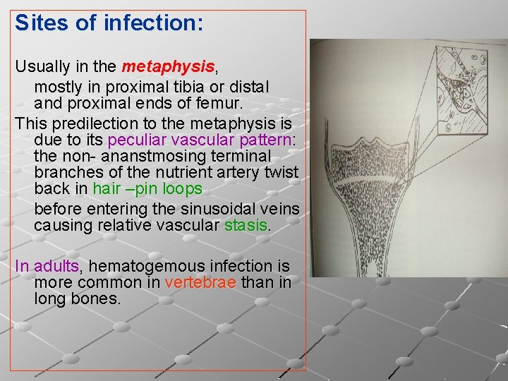 Sites of infection: Usually in the metaphysis, mostly in proximal tibia or distal and