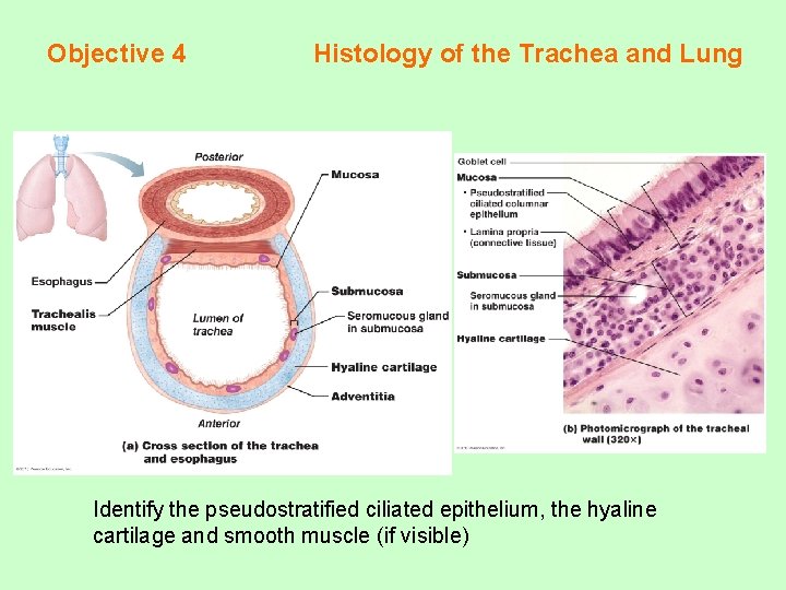 Objective 4 Histology of the Trachea and Lung Identify the pseudostratified ciliated epithelium, the