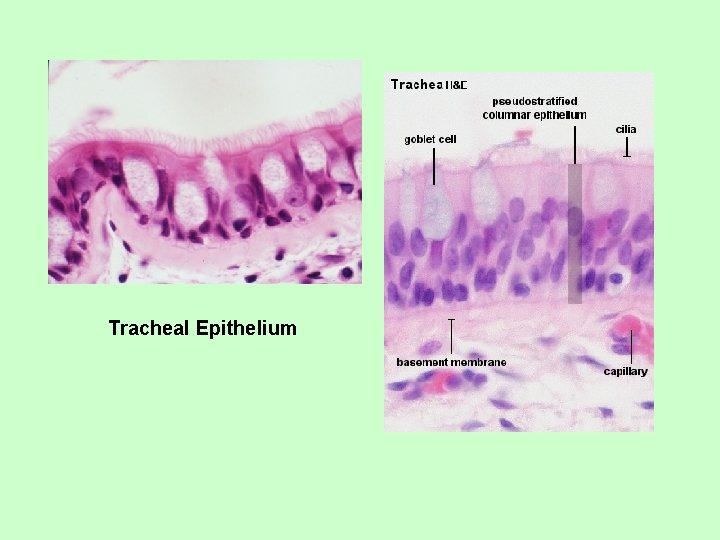 Tracheal Epithelium 