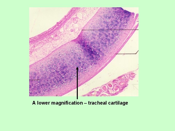 A lower magnification – tracheal cartilage 