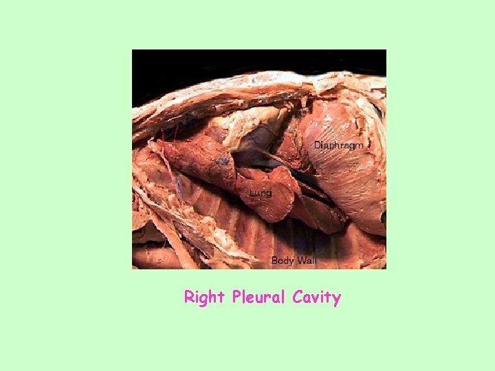 Right Pleural Cavity 