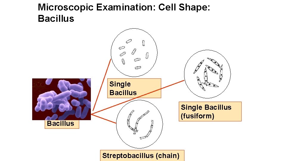 Microscopic Examination: Cell Shape: Bacillus Single Bacillus (fusiform) Bacillus Streptobacillus (chain) 