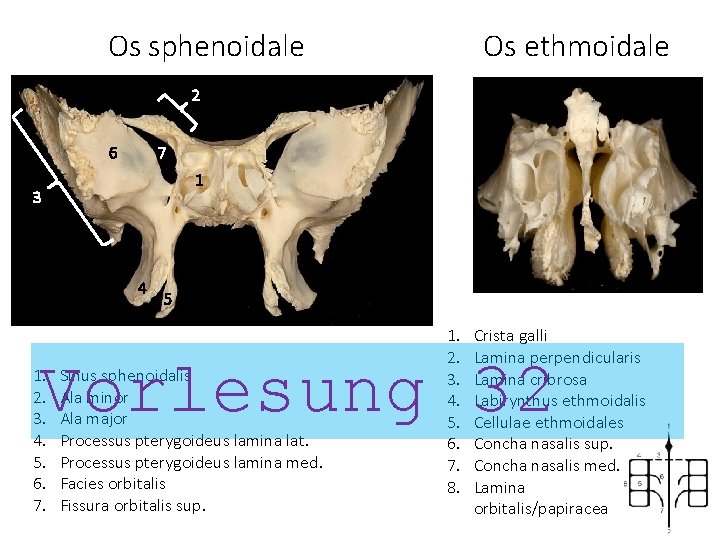 Os sphenoidale Os ethmoidale 2 6 7 1 3 4 5 1. 2. 3.