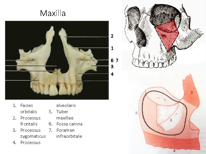 Maxilla 2 1 6 7 3 4 alveolaris 1. Facies orbitalis 5. Tuber 2.