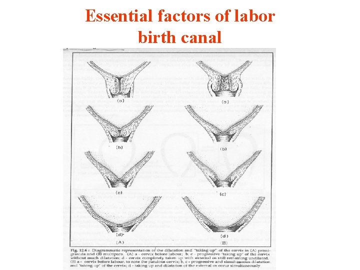Essential factors of labor birth canal 