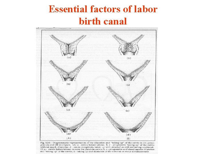 Essential factors of labor birth canal Essential factors of labor birth canal