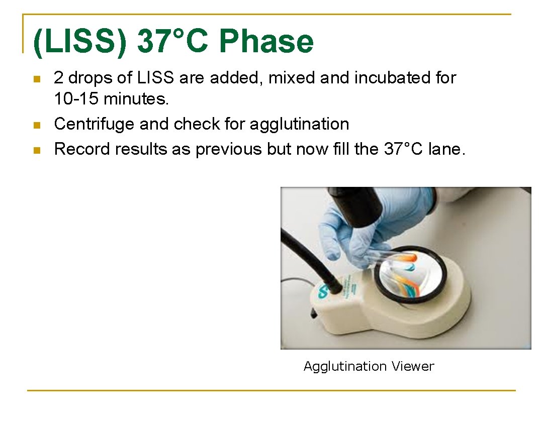 (LISS) 37°C Phase n n n 2 drops of LISS are added, mixed and