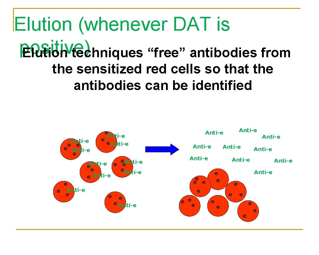 Elution (whenever DAT is positive) Elution techniques “free” antibodies from the sensitized red cells