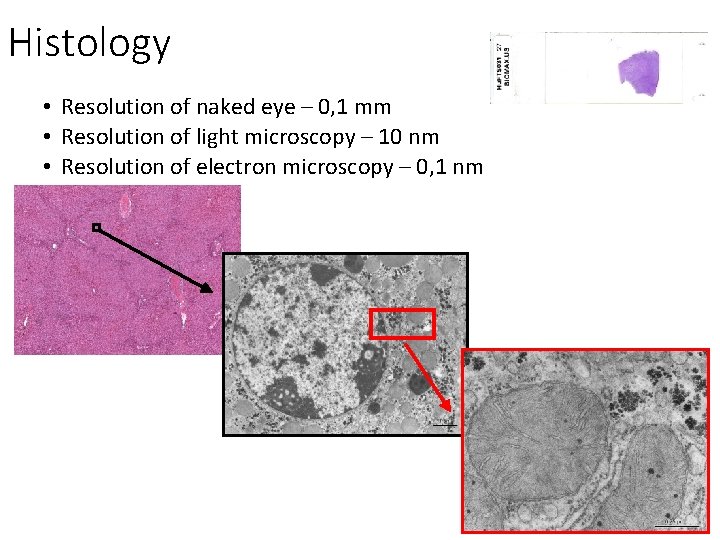 Histology • Resolution of naked eye – 0, 1 mm • Resolution of light