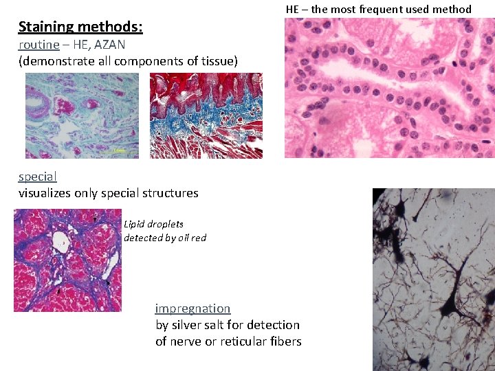 HE – the most frequent used method Staining methods: routine – HE, AZAN (demonstrate