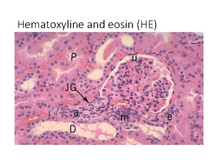 Hematoxyline and eosin (HE) 