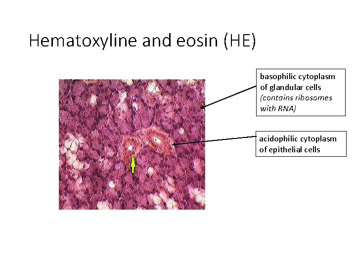 Hematoxyline and eosin (HE) basophilic cytoplasm of glandular cells (contains ribosomes with RNA) acidophilic