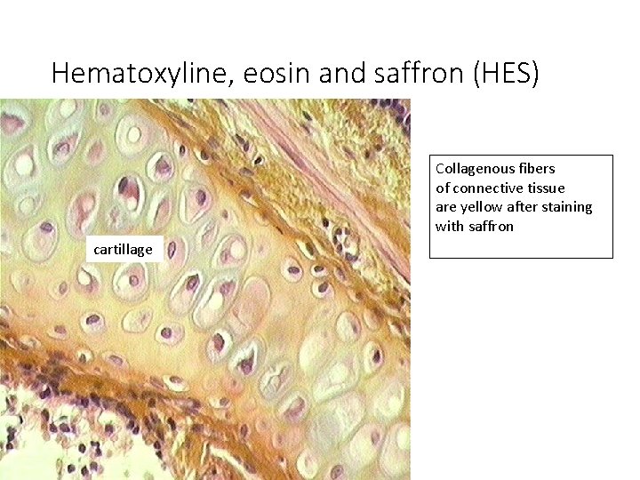 Hematoxyline, eosin and saffron (HES) Collagenous fibers of connective tissue are yellow after staining