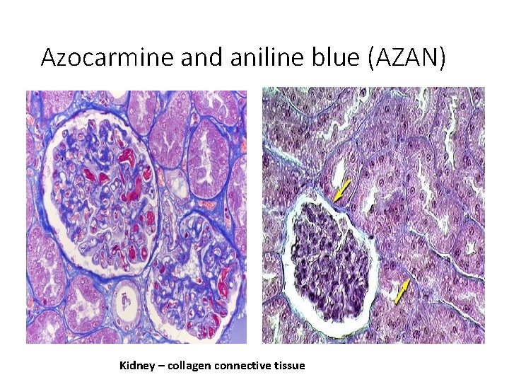 Azocarmine and aniline blue (AZAN) Kidney – collagen connective tissue 