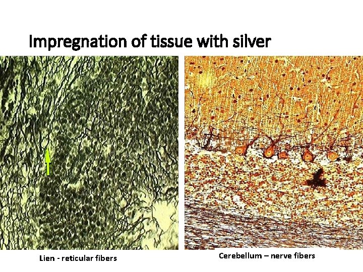 Impregnation of tissue with silver Lien - reticular fibers Cerebellum – nerve fibers 