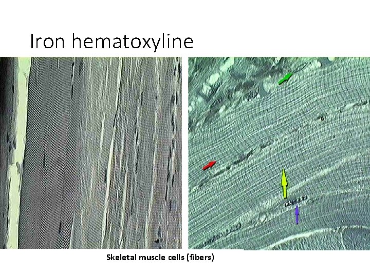 Iron hematoxyline Skeletal muscle cells (fibers) 