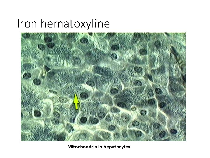 Iron hematoxyline Mitochondria in hepatocytes 