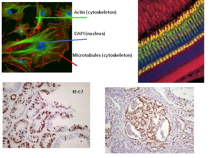 Actin (cytoskeleton) DAPI (nucleus) Microtubules (cytoskeleton) KI-67 