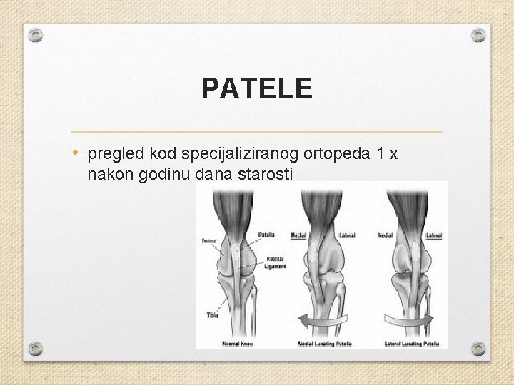 PATELE • pregled kod specijaliziranog ortopeda 1 x nakon godinu dana starosti 