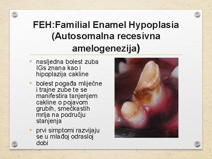 FEH: Familial Enamel Hypoplasia (Autosomalna recesivna amelogenezija) • nasljedna bolest zuba IGs znana kao