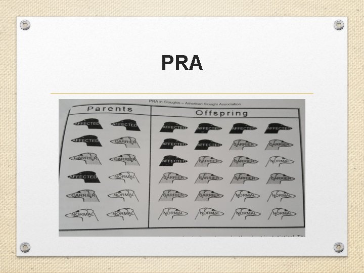 PRA 