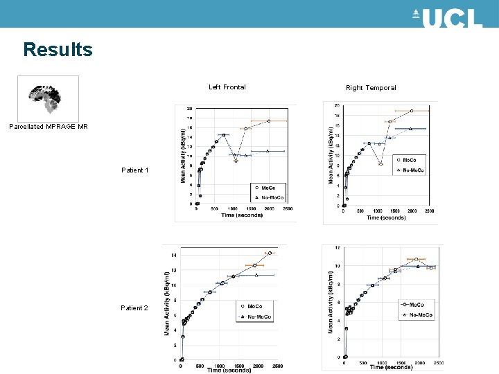 Results Left Frontal Parcellated MPRAGE MR Patient 1 Patient 2 Right Temporal 