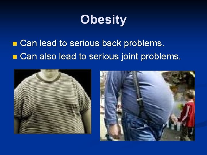 Obesity Can lead to serious back problems. n Can also lead to serious joint