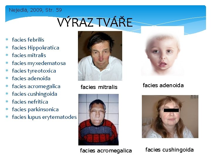 Nejedlá, 2009, Str. 59 VÝRAZ TVÁŘE facies febrilis facies Hippokratica facies mitralis facies myxedematosa