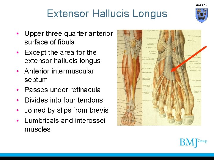 MOB TCD Extensor Hallucis Longus • Upper three quarter anterior surface of fibula •