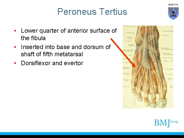 MOB TCD Peroneus Tertius • Lower quarter of anterior surface of the fibula •