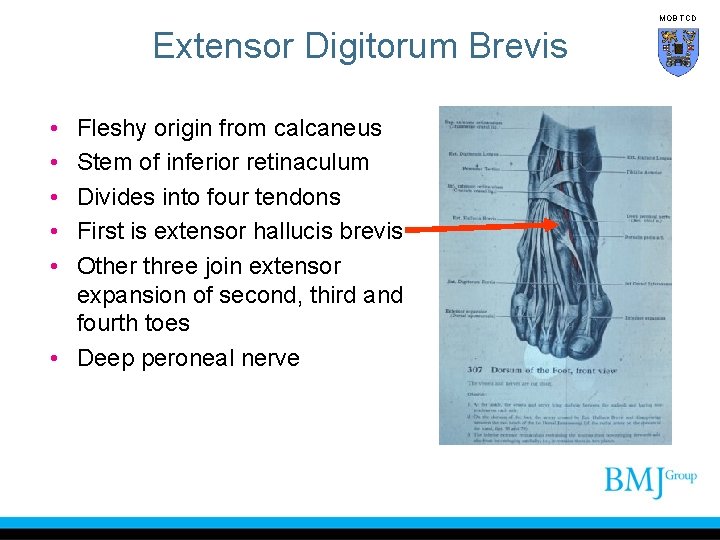 MOB TCD Extensor Digitorum Brevis • • • Fleshy origin from calcaneus Stem of