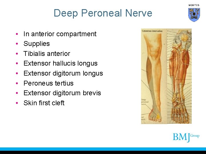 MOB TCD Deep Peroneal Nerve • • In anterior compartment Supplies Tibialis anterior Extensor