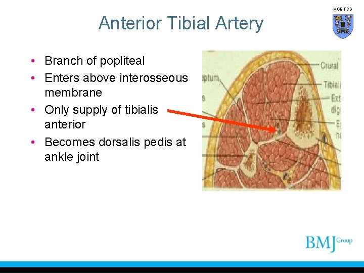MOB TCD Anterior Tibial Artery • Branch of popliteal • Enters above interosseous membrane