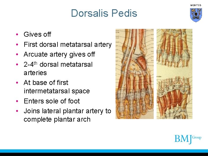 MOB TCD Dorsalis Pedis • • Gives off First dorsal metatarsal artery Arcuate artery