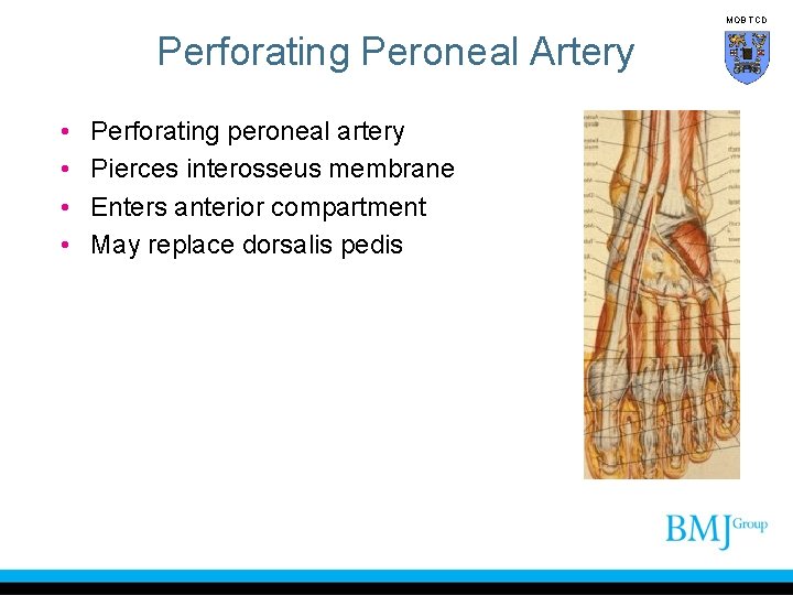 MOB TCD Perforating Peroneal Artery • • Perforating peroneal artery Pierces interosseus membrane Enters