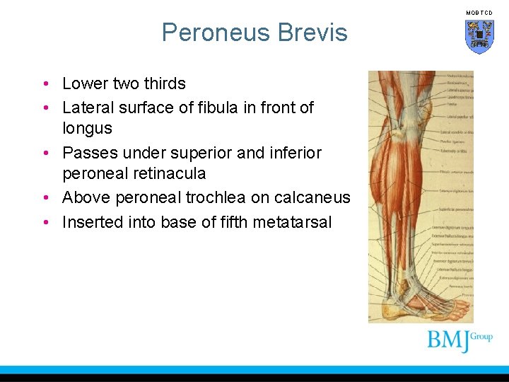 MOB TCD Peroneus Brevis • Lower two thirds • Lateral surface of fibula in
