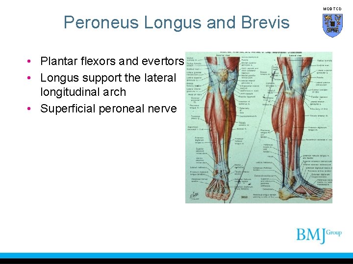 MOB TCD Peroneus Longus and Brevis • Plantar flexors and evertors • Longus support