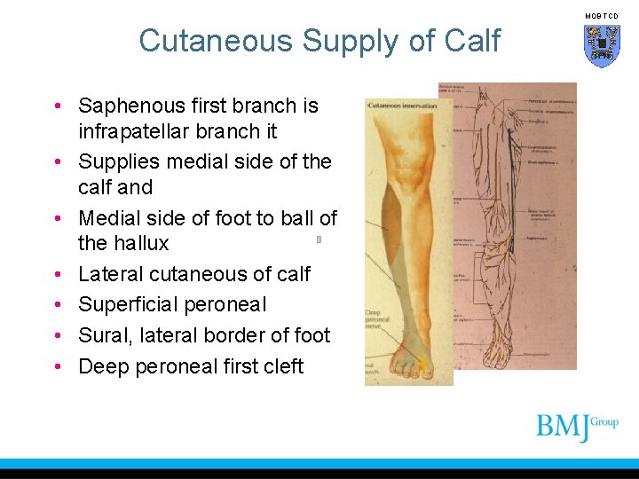 MOB TCD Cutaneous Supply of Calf • Saphenous first branch is infrapatellar branch it