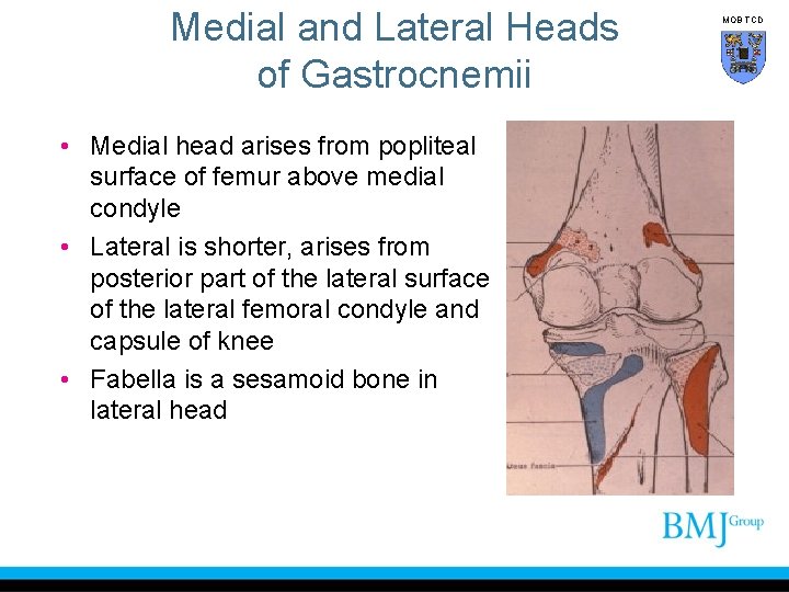 Medial and Lateral Heads of Gastrocnemii • Medial head arises from popliteal surface of