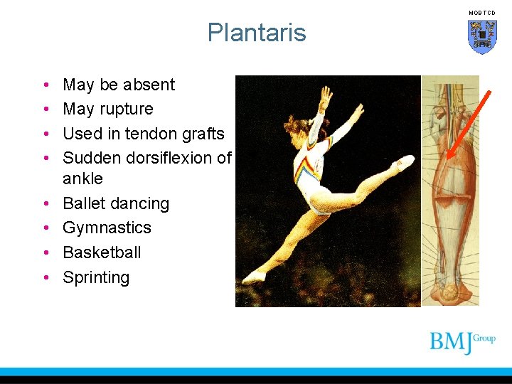 MOB TCD Plantaris • • May be absent May rupture Used in tendon grafts