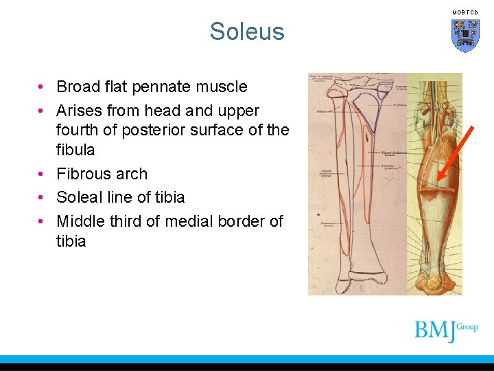 MOB TCD Soleus • Broad flat pennate muscle • Arises from head and upper