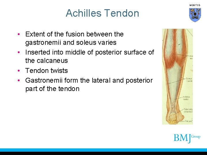 MOB TCD Achilles Tendon • Extent of the fusion between the gastronemii and soleus