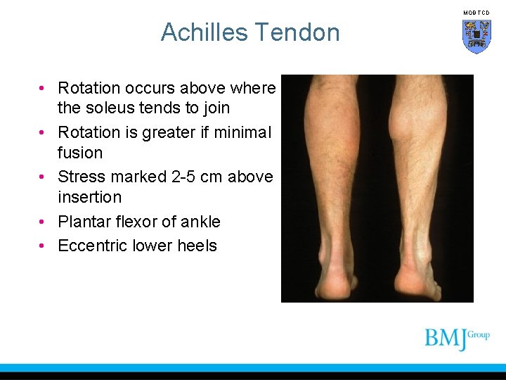 MOB TCD Achilles Tendon • Rotation occurs above where the soleus tends to join