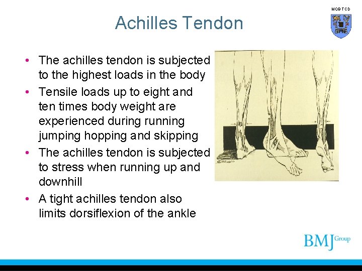 MOB TCD Achilles Tendon • The achilles tendon is subjected to the highest loads