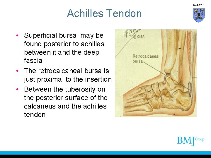 MOB TCD Achilles Tendon • Superficial bursa may be found posterior to achilles between