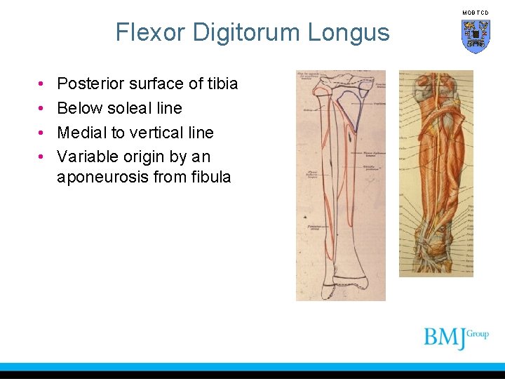 MOB TCD Flexor Digitorum Longus • • Posterior surface of tibia Below soleal line