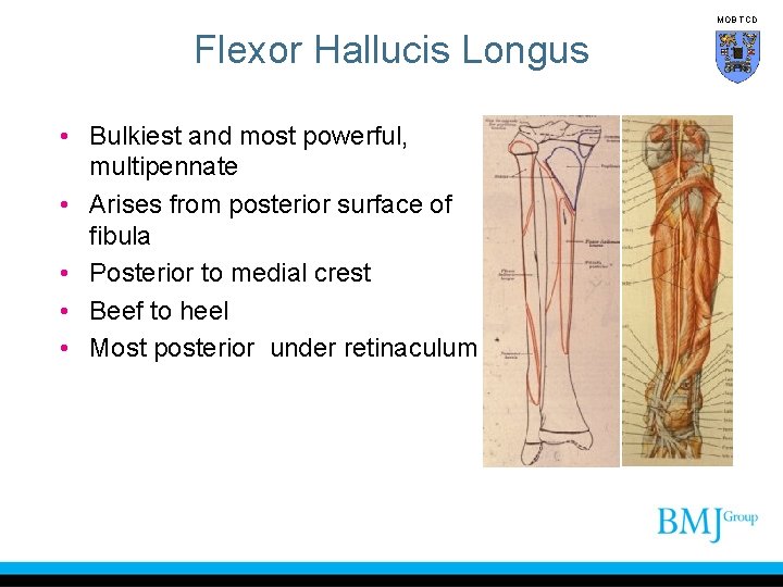MOB TCD Flexor Hallucis Longus • Bulkiest and most powerful, multipennate • Arises from