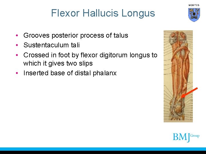 MOB TCD Flexor Hallucis Longus • Grooves posterior process of talus • Sustentaculum tali