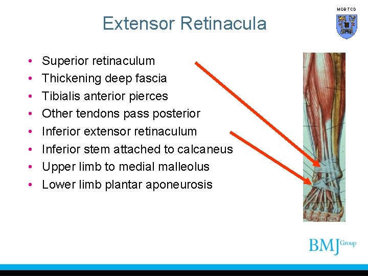 MOB TCD Extensor Retinacula • • Superior retinaculum Thickening deep fascia Tibialis anterior pierces