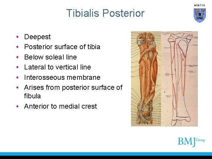 MOB TCD Tibialis Posterior • • • Deepest Posterior surface of tibia Below soleal